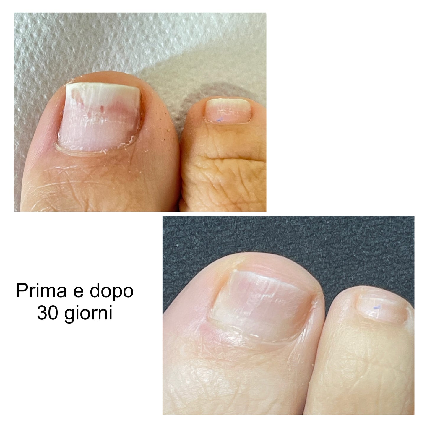 DemykoMed Italia Olio protettivo per unghie cura per unghie fragili e sensibili ai funghi. 15ml